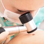 Consulter un dermatologue