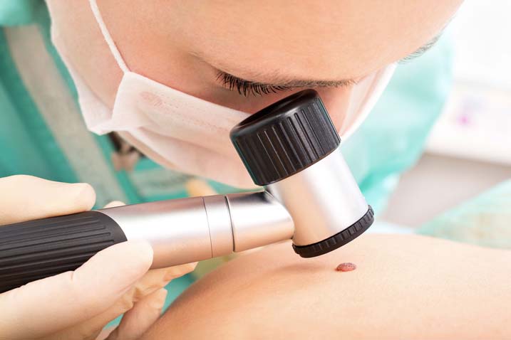Consulter un dermatologue : les critères à considérer avant de prendre une décision